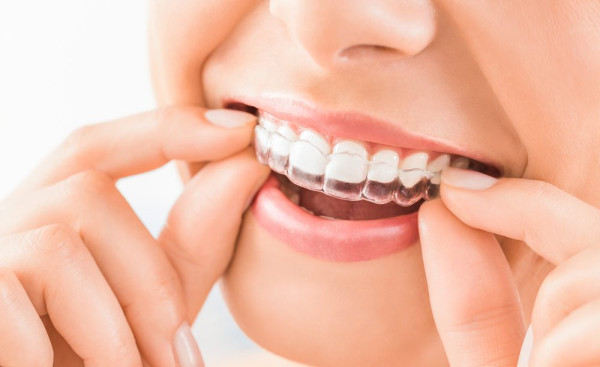 マウスピースがきついかも 原因と対処方法を解説 Smileteeth スマイルティース