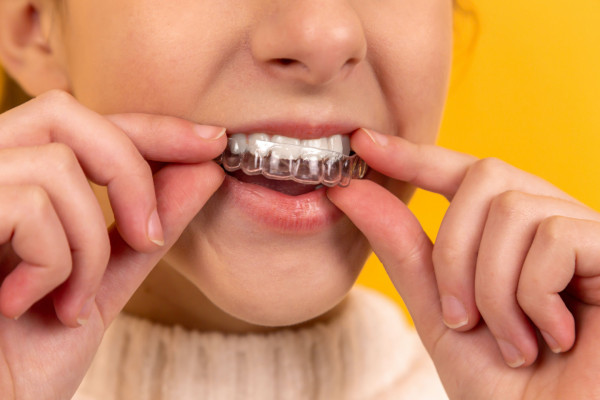 大人の歯列矯正に使われる装置とその特徴